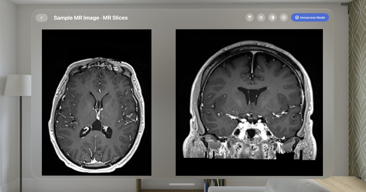 VoxelVision AR Medical Imaging
